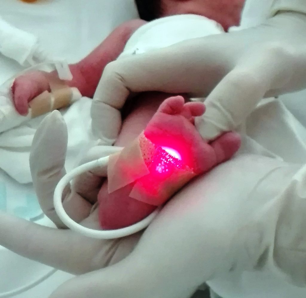 Foto: Cribado de cardiopatías congénitas críticas en recién nacidos
