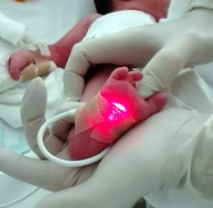 Foto: Cribado de cardiopatías congénitas críticas en recién nacidos