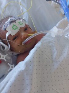 Carlitos, después de su operación de corazón, en la UCI.